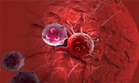 سرطان‌های شایع در زنان/دو سوم سرطان‌ها قابل پیشگیری است