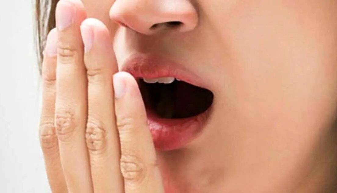 سفیدی روی زبان برای چیست؟/ روش رفع بوی بد دهان