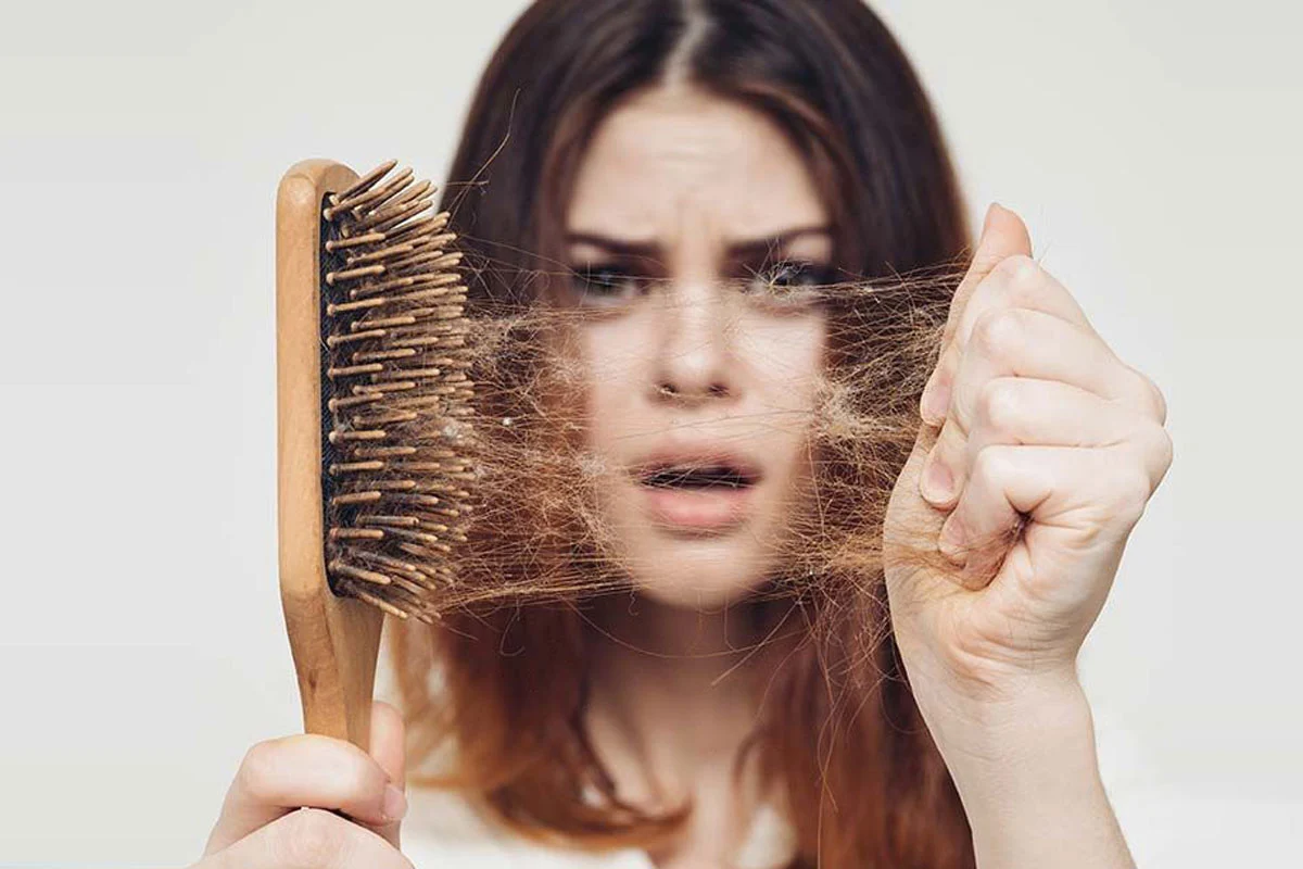 شایعترین علت ریزش مو در خانمها و آقایان ارث است