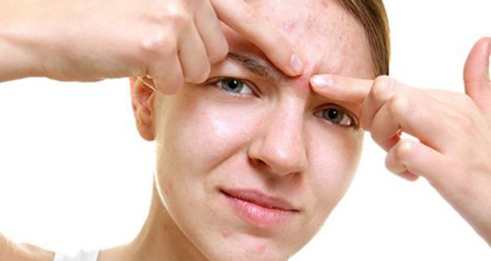 هشدار مهم برای کسانی که جوش‌هایشان را می‌ترکانند!