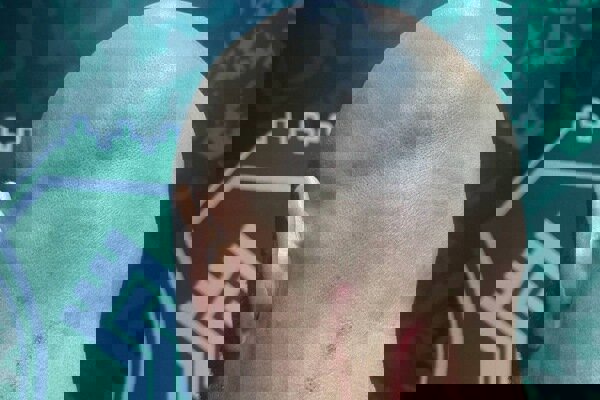 جراحت مربی دروازه‌بان‌های استقلال در پایان بازی با خیبر