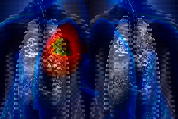 سختی‌ها و ملاحظاتی که برای جراحی ریه باید انجام شود