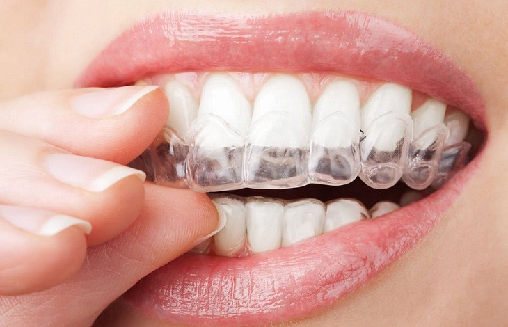 بلیچینگ دندان؛ از اصول علمی تا ملاحظات بالینی