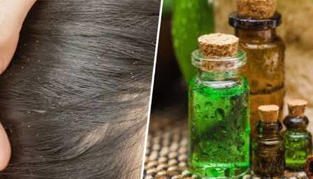 آیا مالیدن روغن‌ شوره سر را از بین می‌برد؟